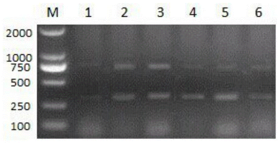 Double PCR (polymerase chain reaction) method for detecting Streptococcus suis type 2 and Haemophilus parasuis