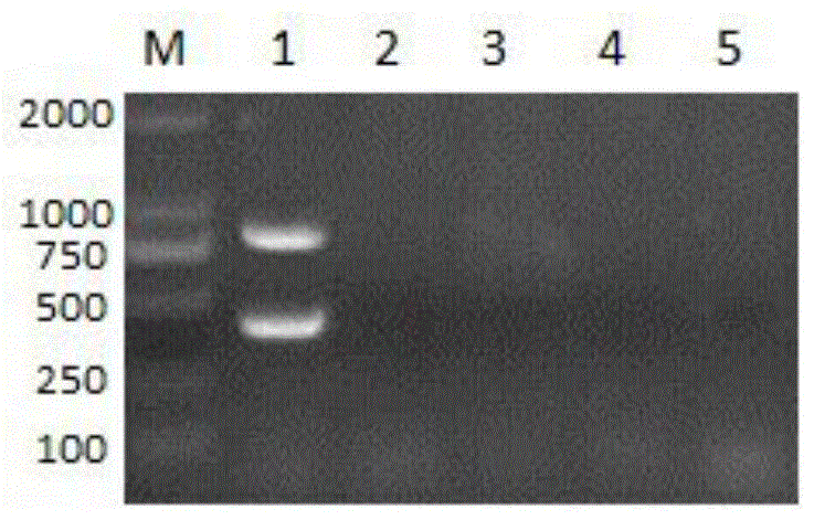 Double PCR (polymerase chain reaction) method for detecting Streptococcus suis type 2 and Haemophilus parasuis