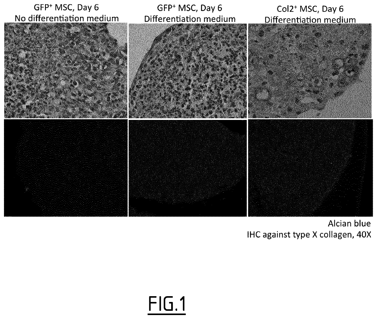 Hybrid promoters and their uses in therapy, notably for treating type ii collagenopathies