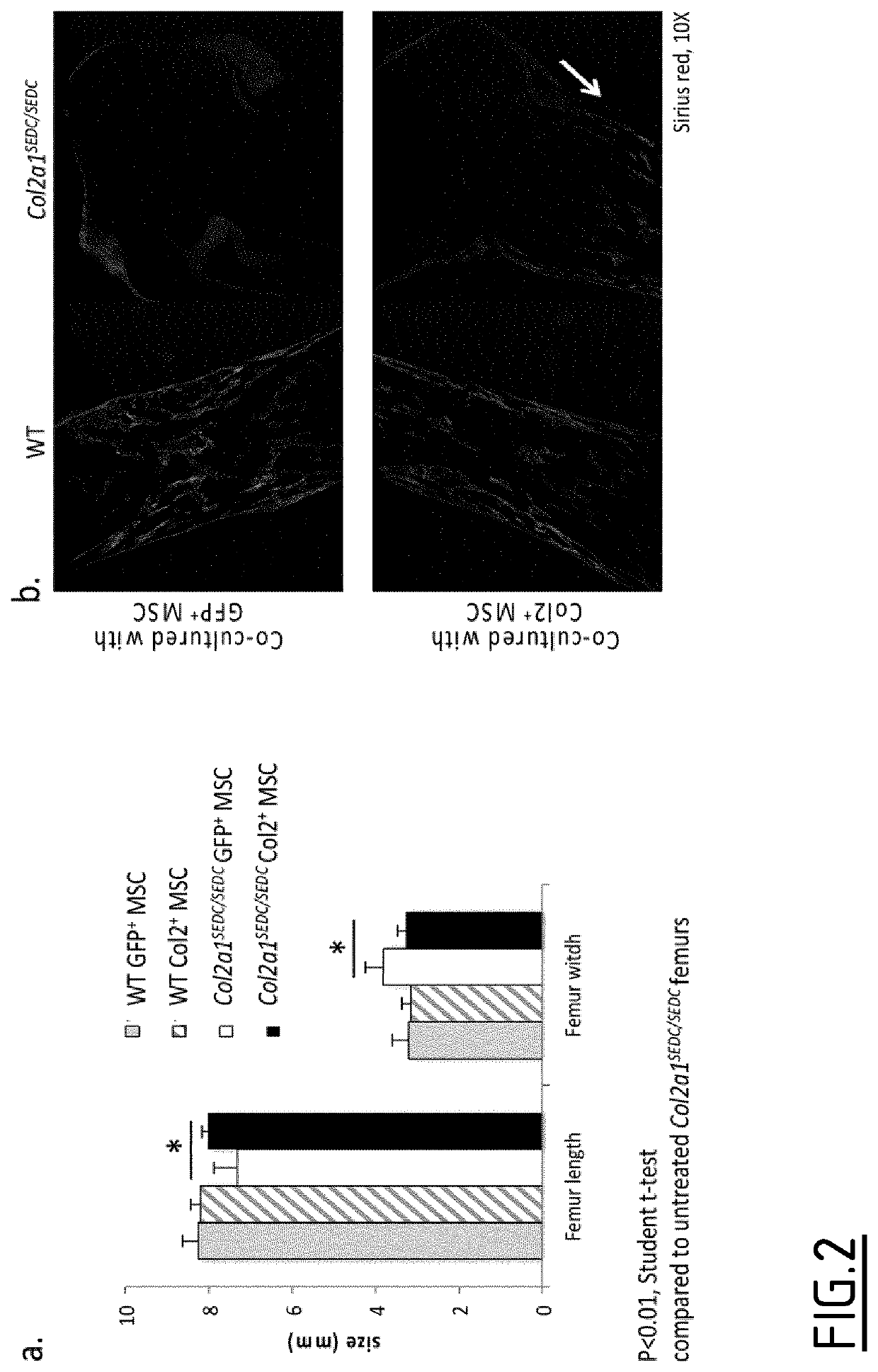 Hybrid promoters and their uses in therapy, notably for treating type ii collagenopathies