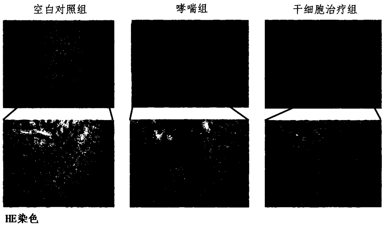 Uses of dental pulp stem cells in preparation of asthma treating drugs