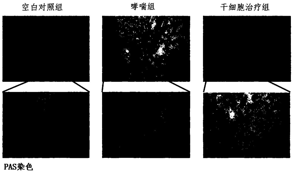 Uses of dental pulp stem cells in preparation of asthma treating drugs