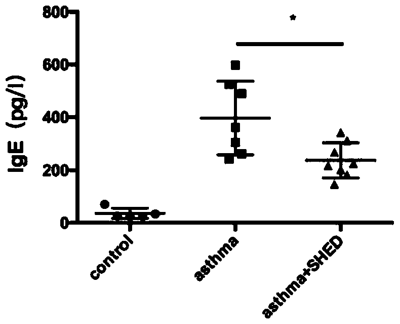 Uses of dental pulp stem cells in preparation of asthma treating drugs