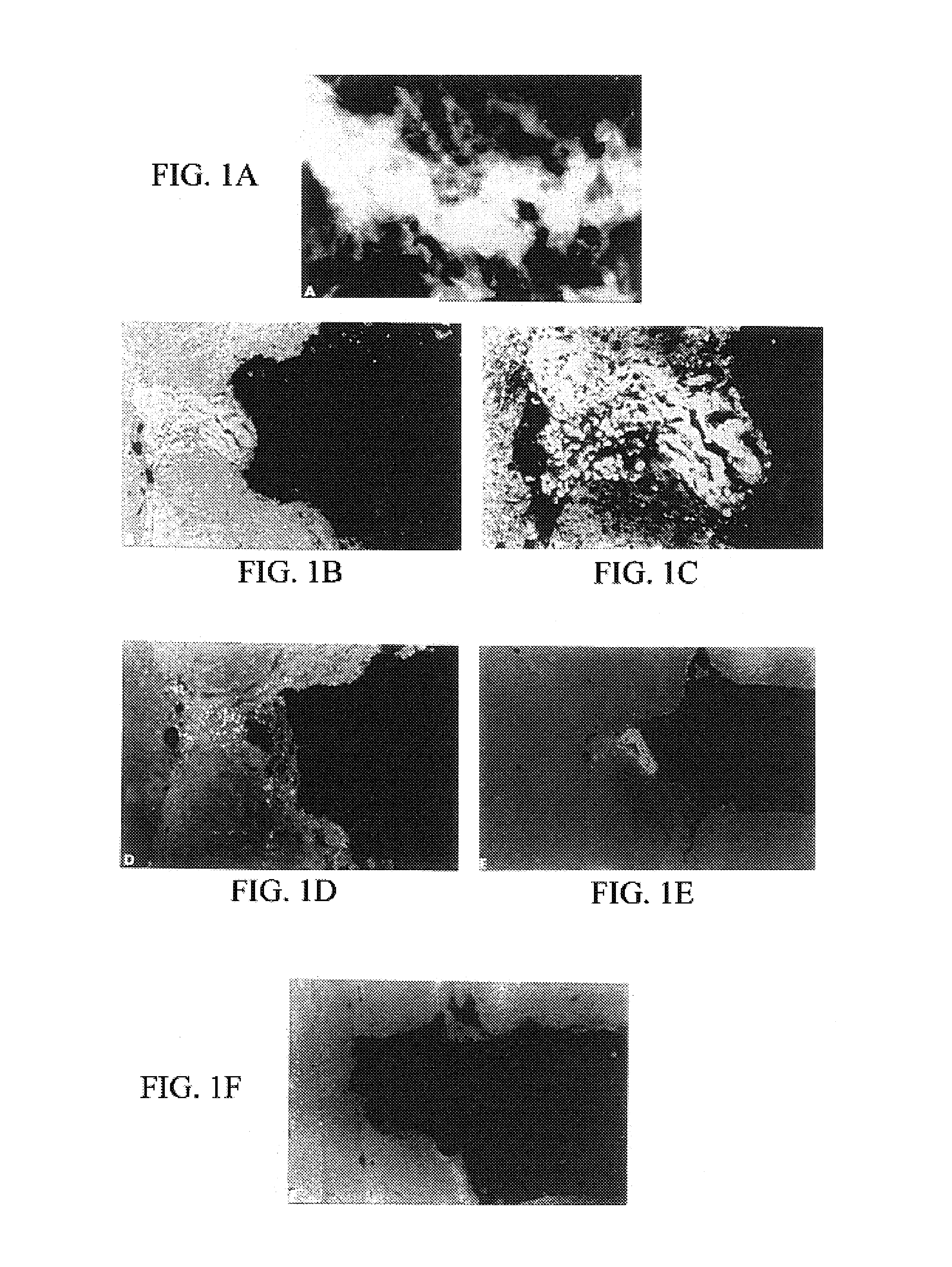 Compositions for labeling beta-amyloid plaques and neurofibrillary tangles