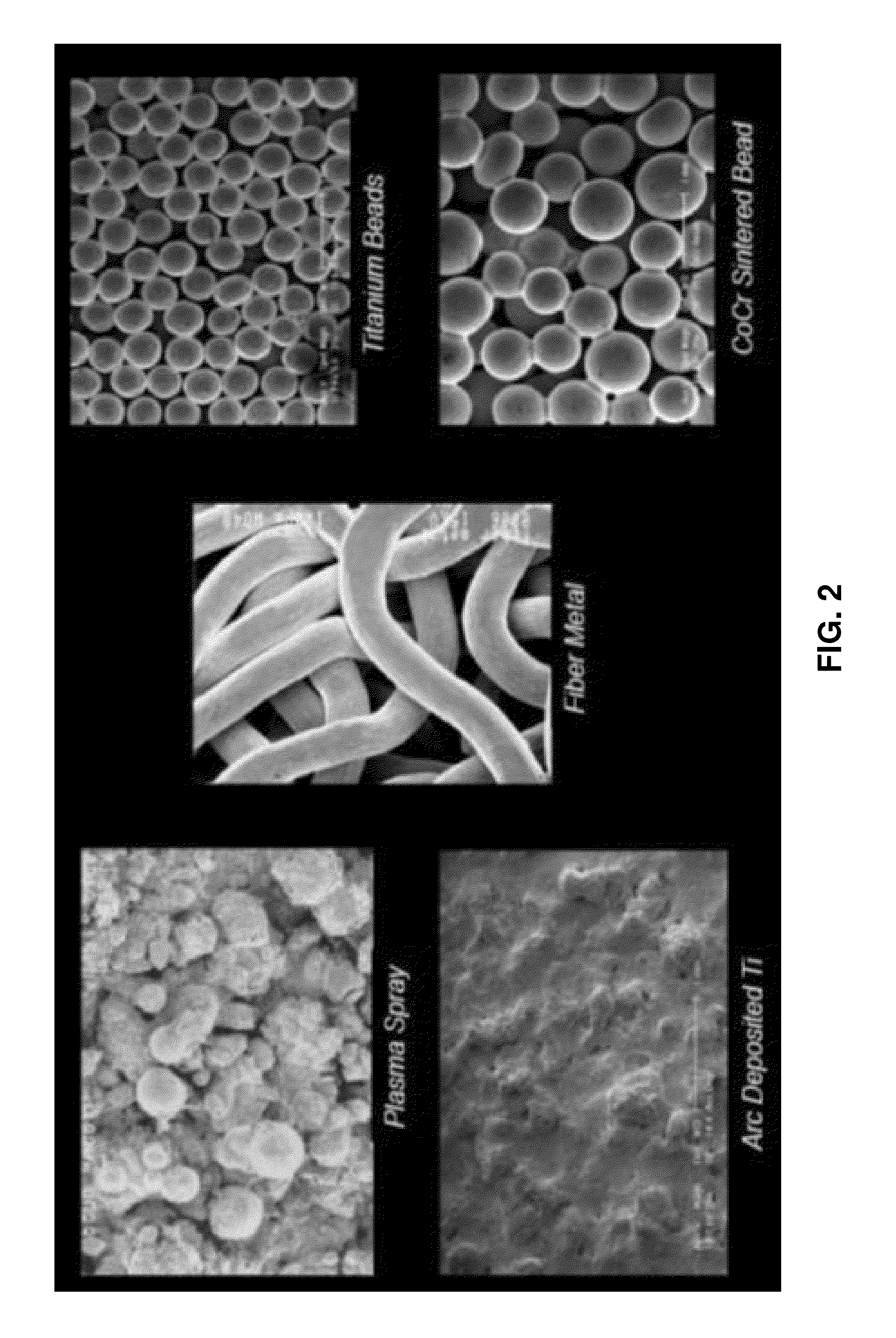 Porous coating for orthopedic implant utilizing porous, shape memory materials