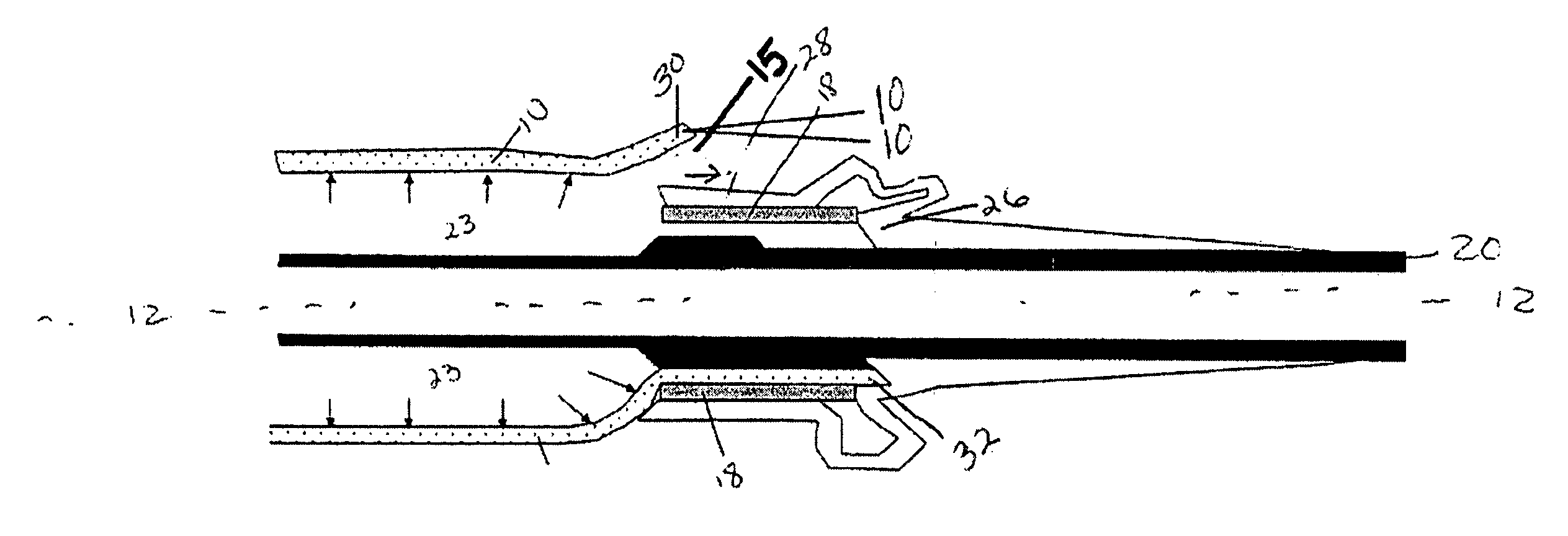 Controlled release mechanism for balloon catheters