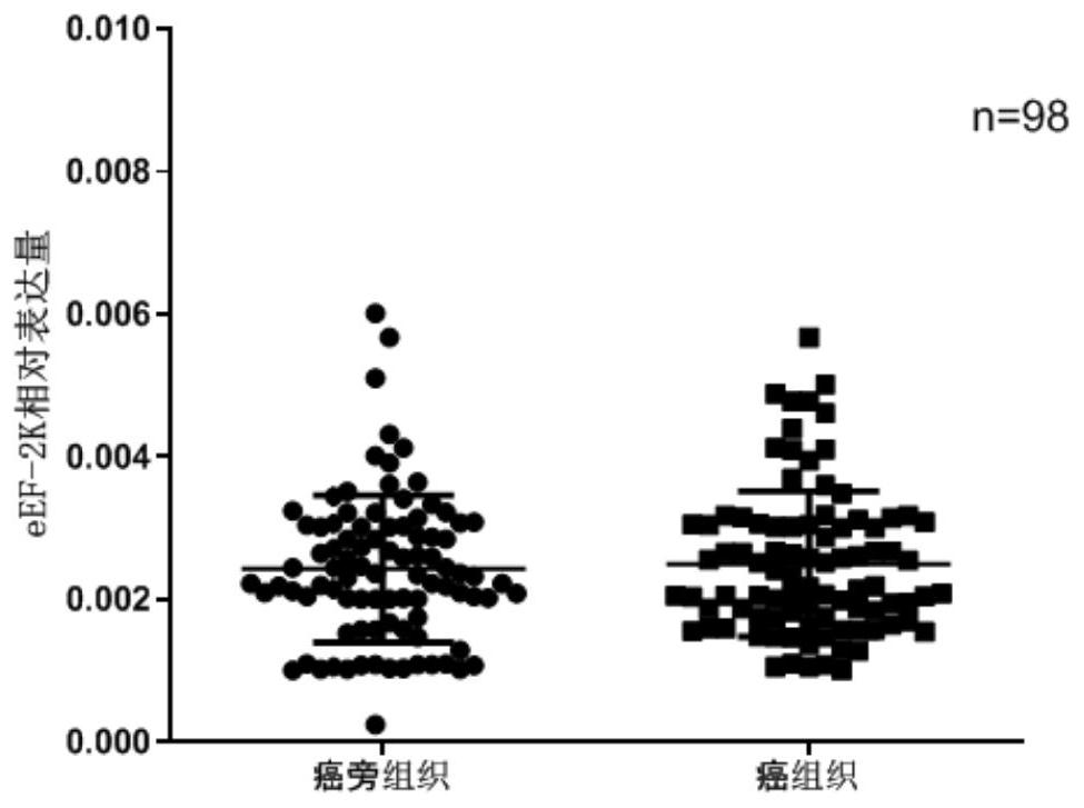 Application of eEF-2K protein and coding gene thereof in liver tumor diagnosis and treatment