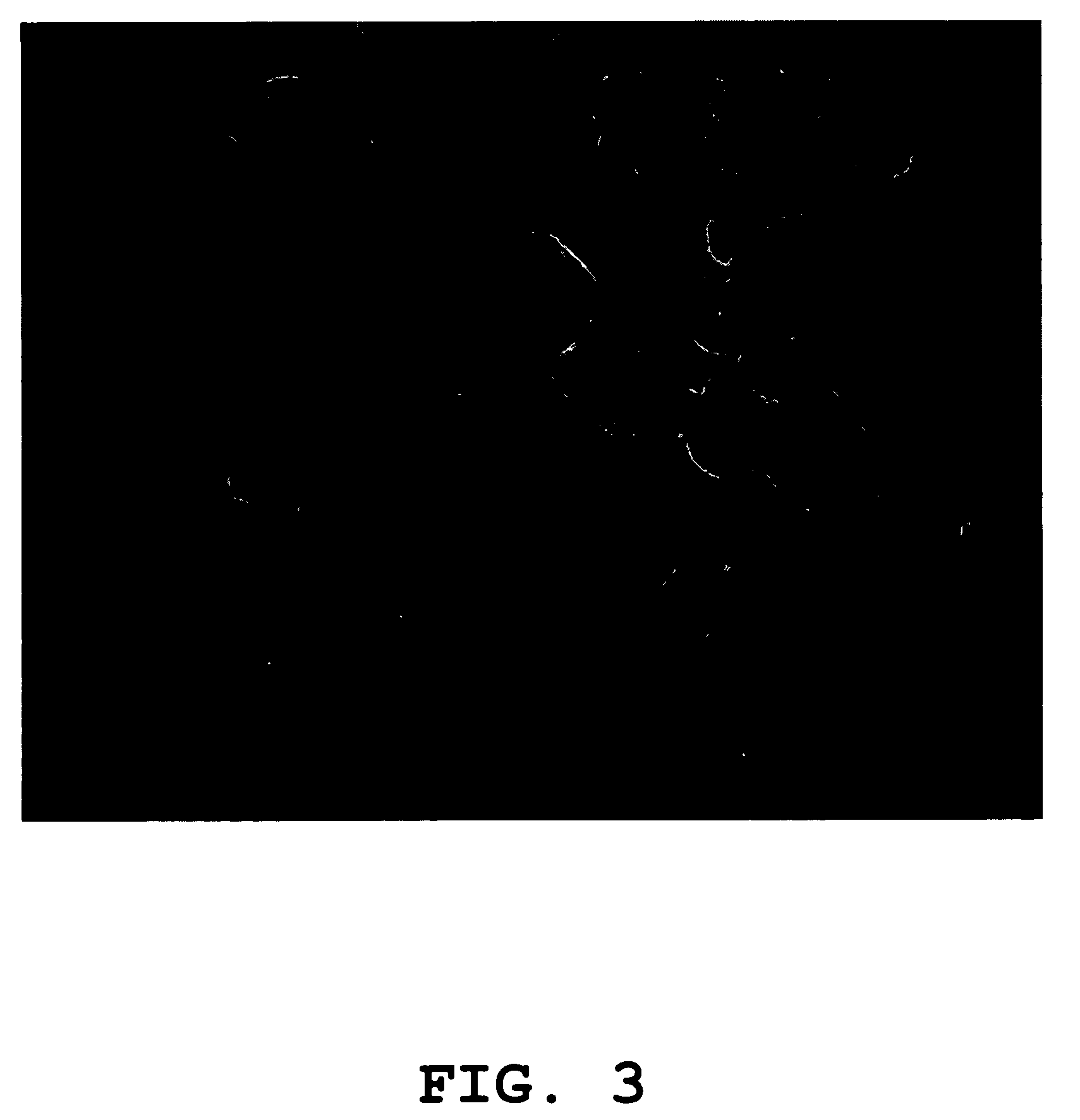 High-throughput diagnostic assay for the human virus causing severe acute respiratory syndrome (SARS)