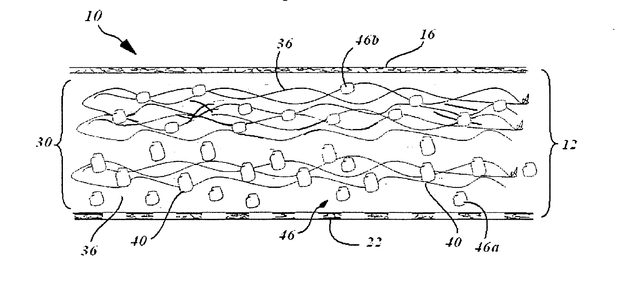 In situ system for intra-articular chondral and osseus tissue repair