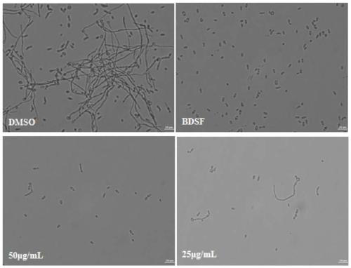 A compound for preventing and treating Candida albicans and its preparation method and application