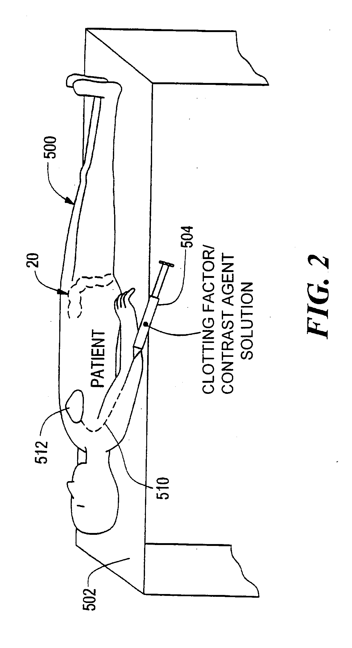 Method and product for locating an internal bleeding site