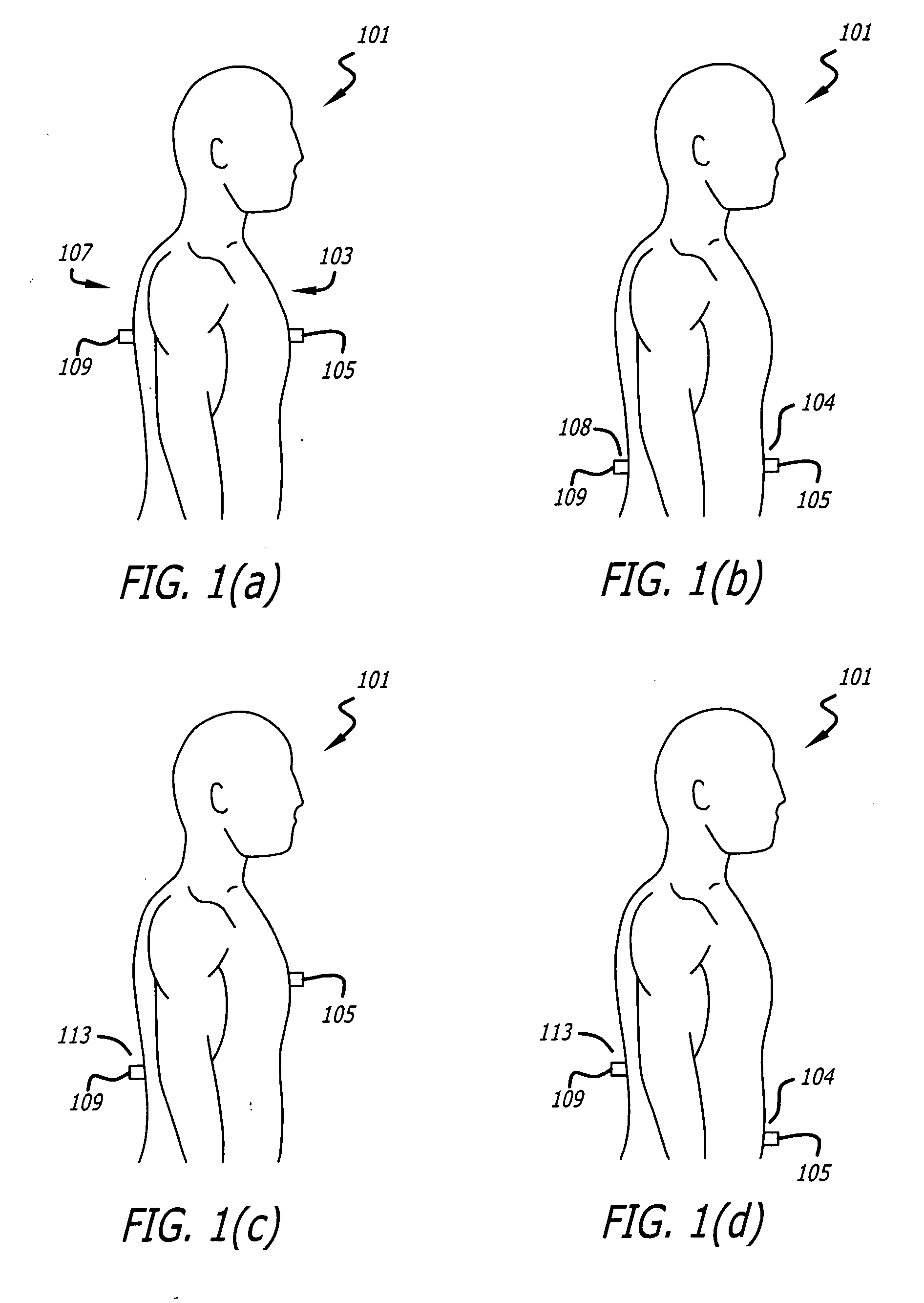 Vantilation and volume change measurements using permanent magnet and magnet sensor affixed to body