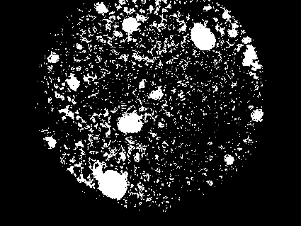 Fixed-decalcifying fluid for bone marrow biopsy and paraffin section method of bone marrow biopsy tissue