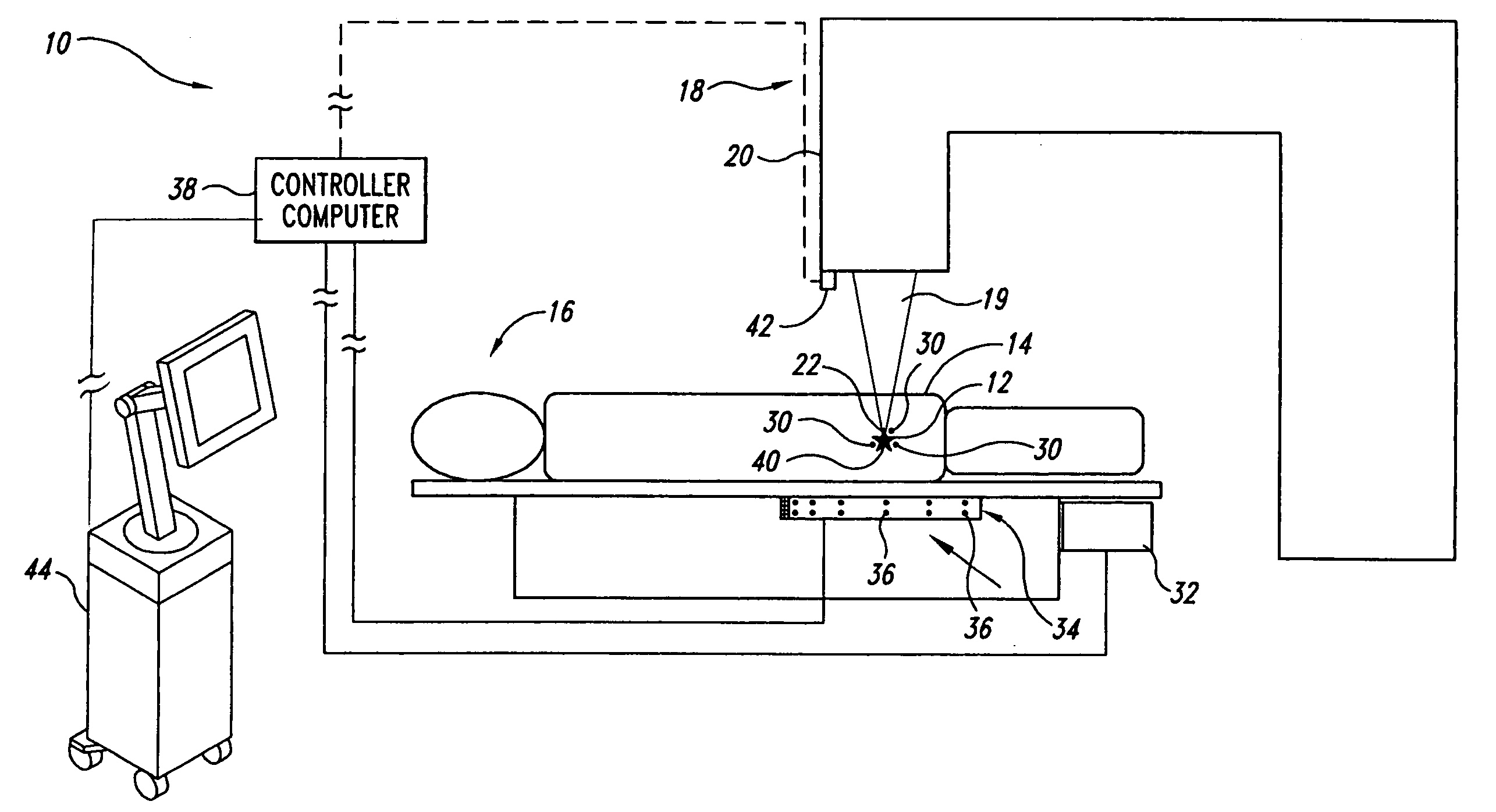 Guided radiation therapy system