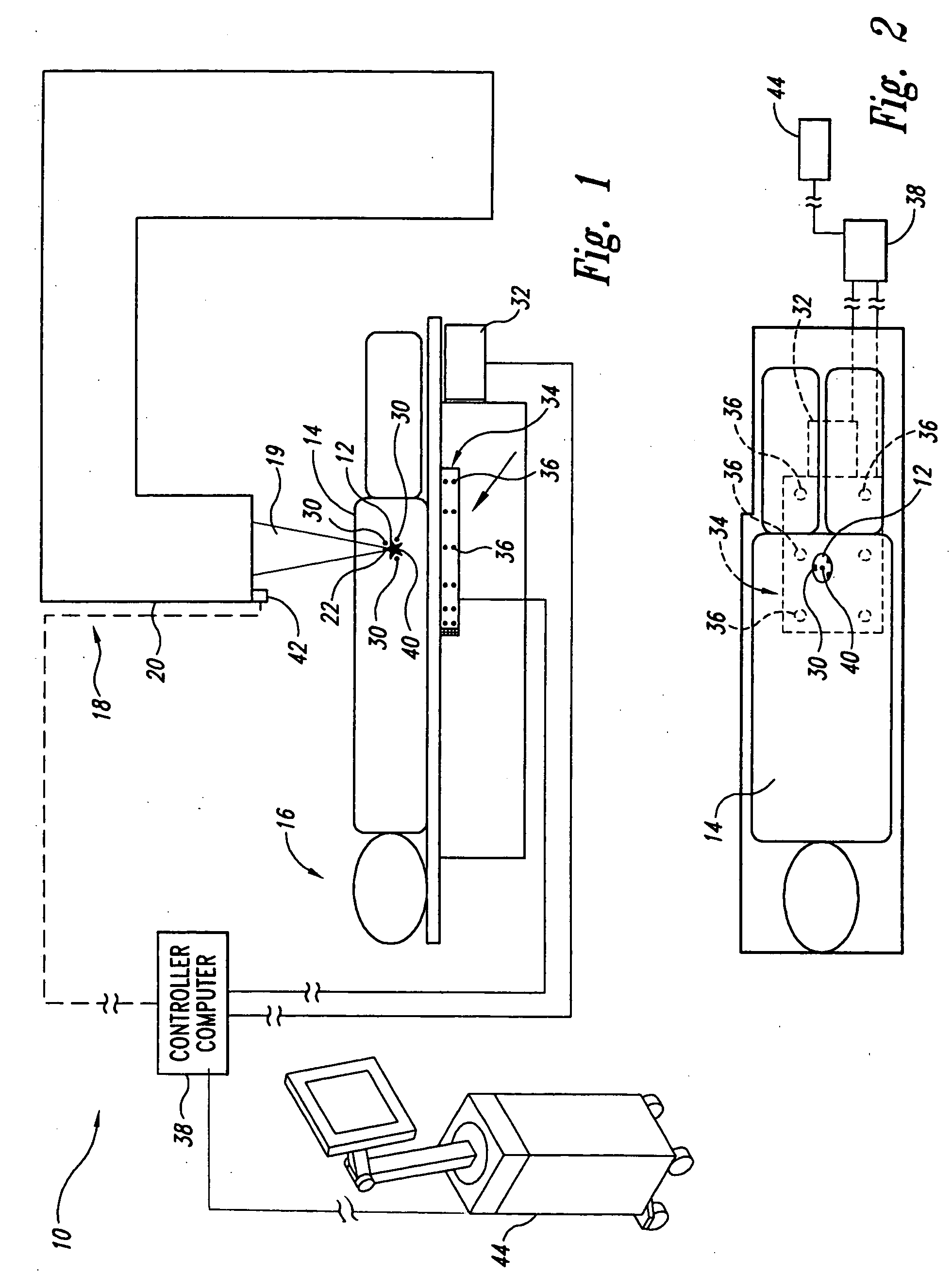 Guided radiation therapy system