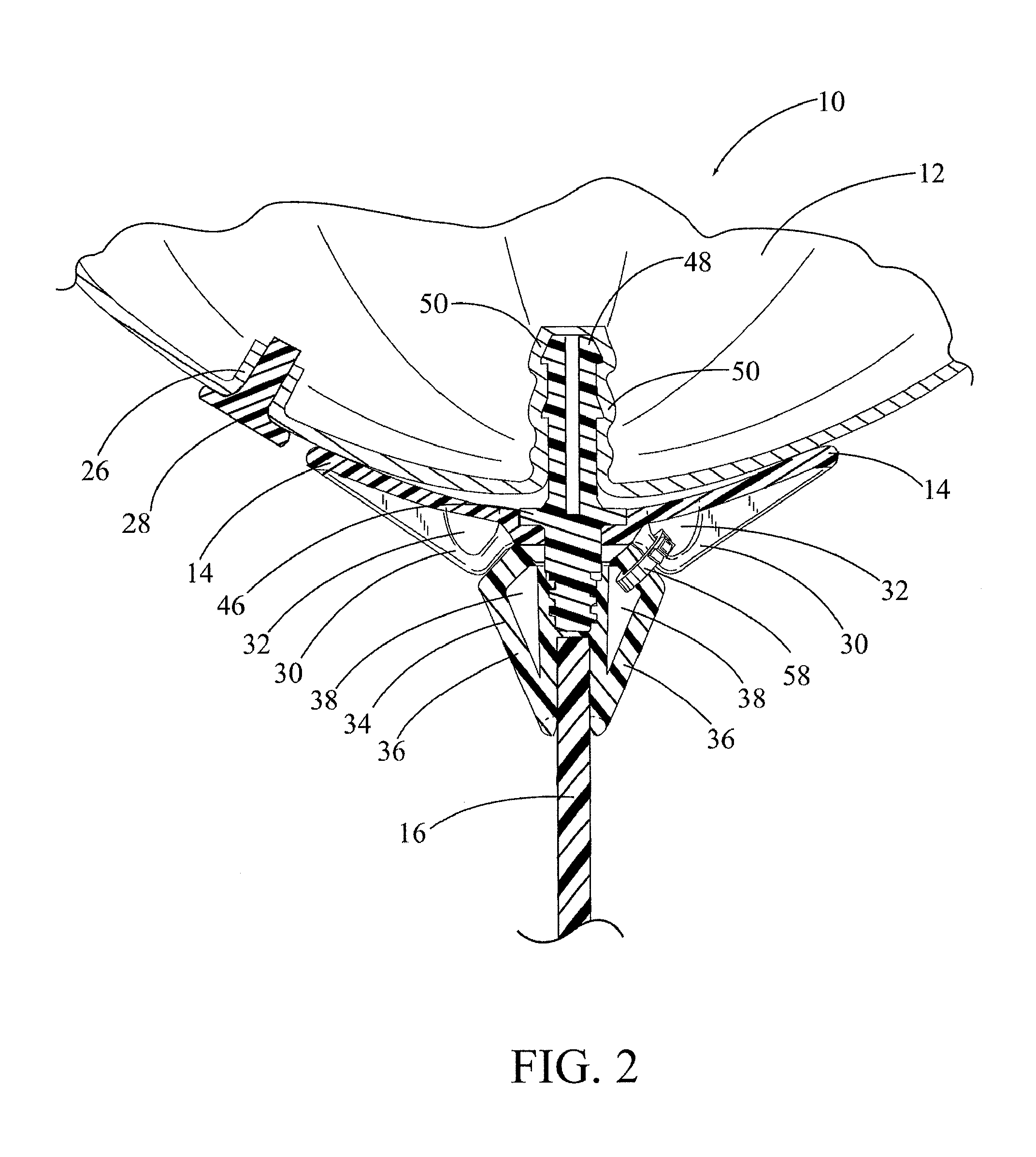 Balloon display system with inflatable balloon, balloon holder cup and flexible rod with mounting pole