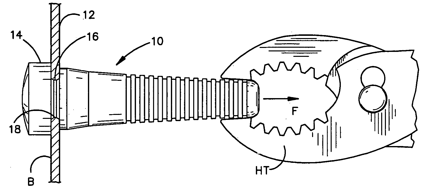 Poultry picking finger and mounting structure