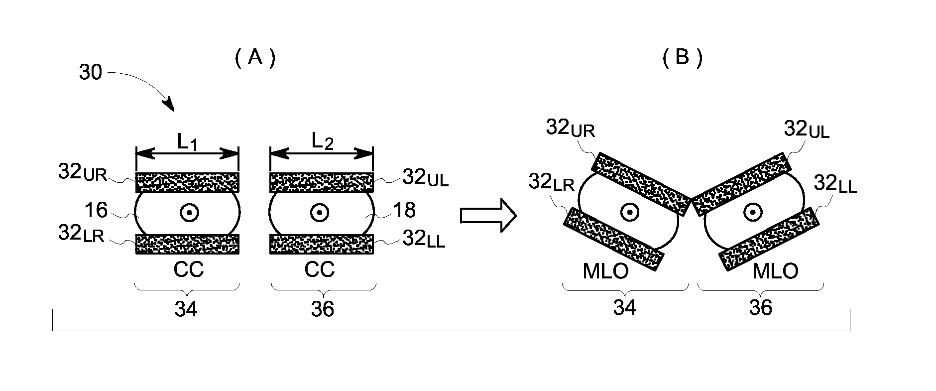 Molecular breast imaging apparatus and method for concurrent dual-breast imaging