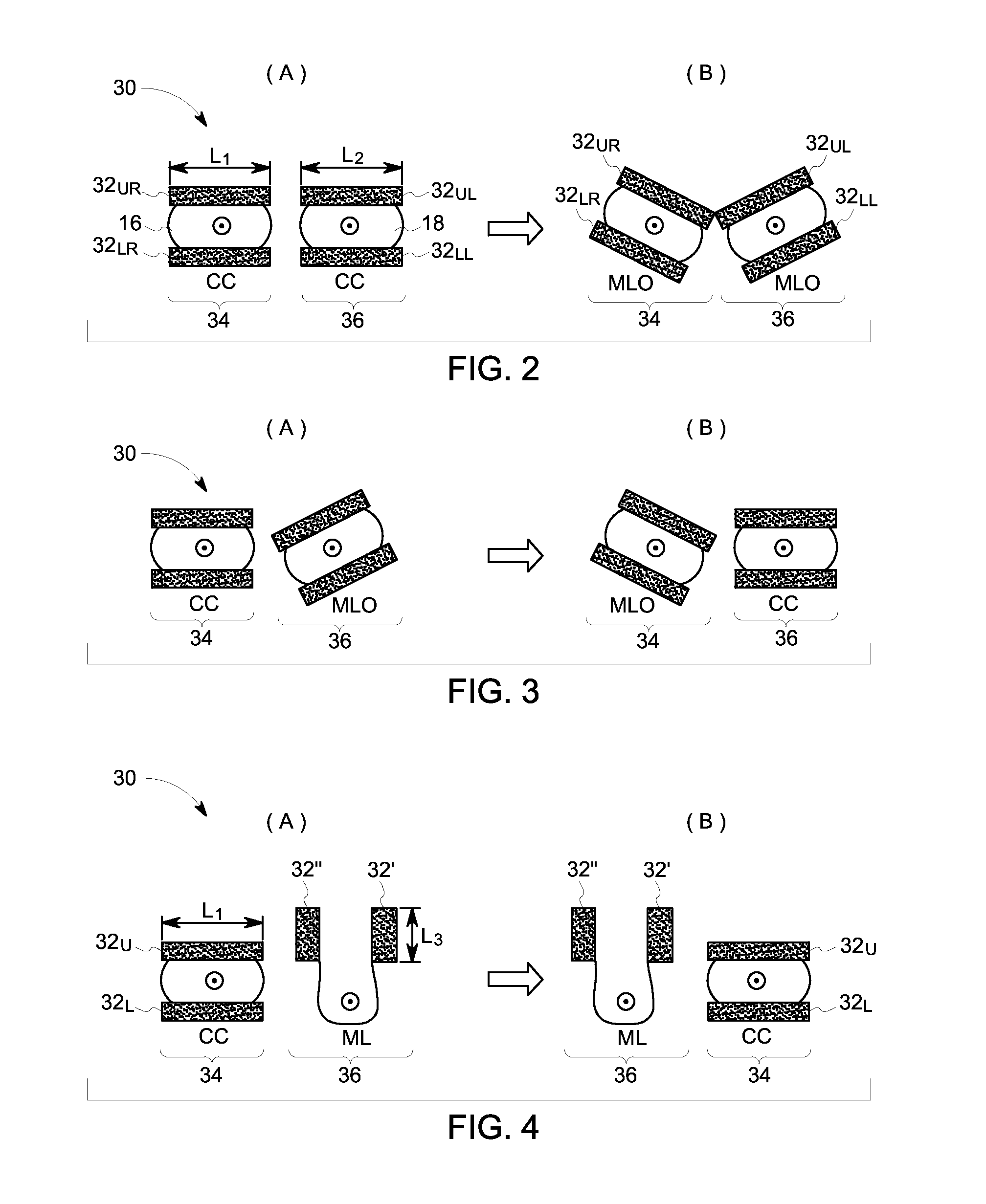 Molecular breast imaging apparatus and method for concurrent dual-breast imaging