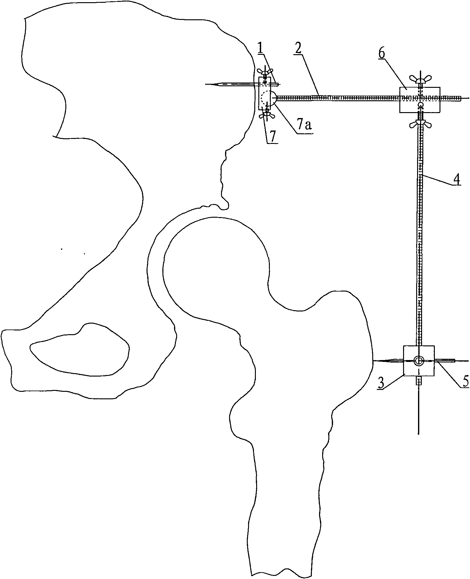 Measurer of eccentric distance of hip joint and extended limb length