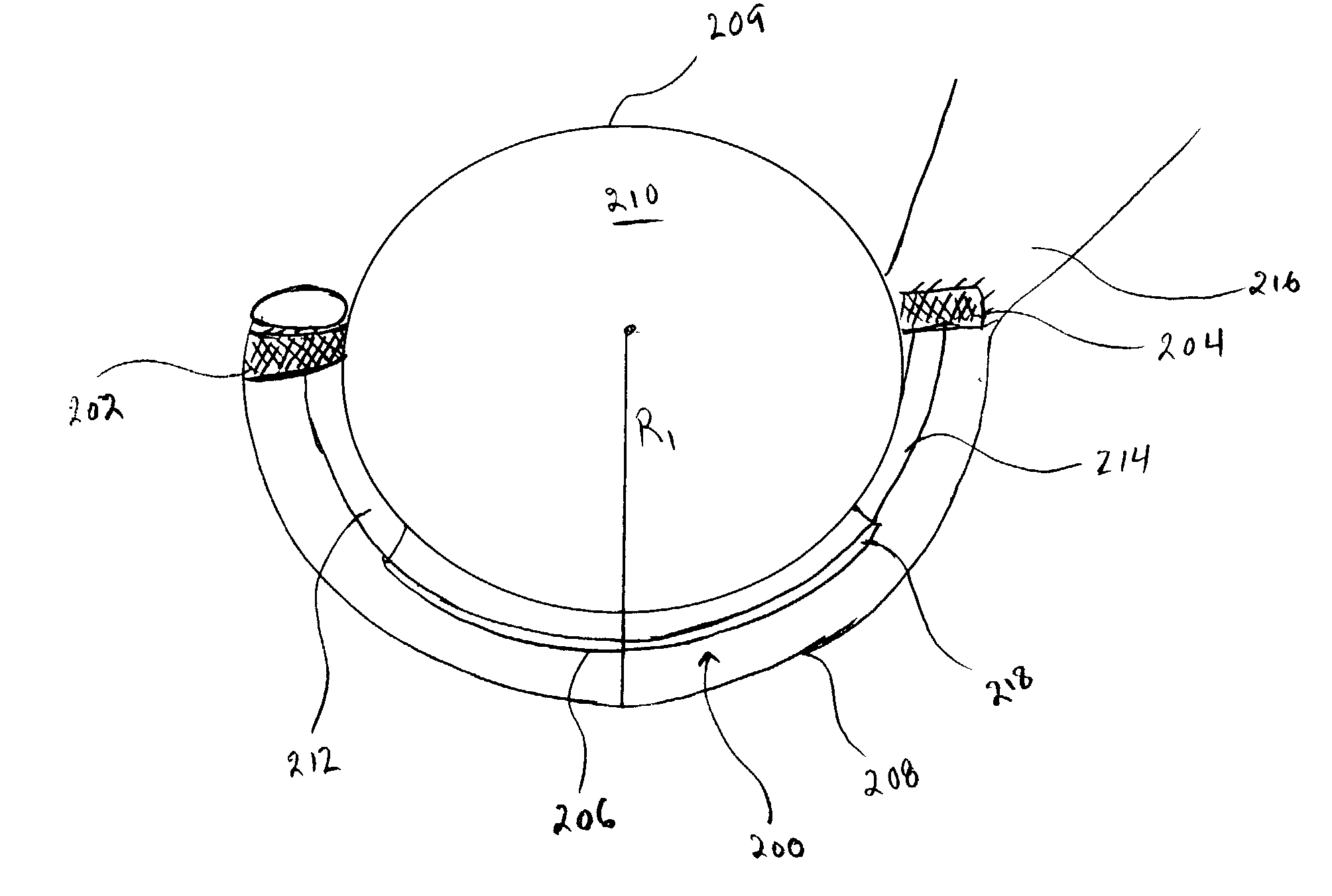 Apparatuses and methods for heart valve repair