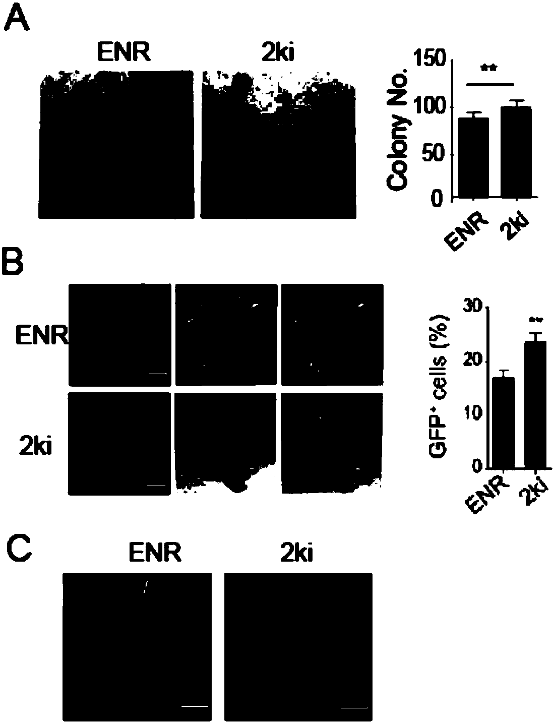 Culture medium and application thereof