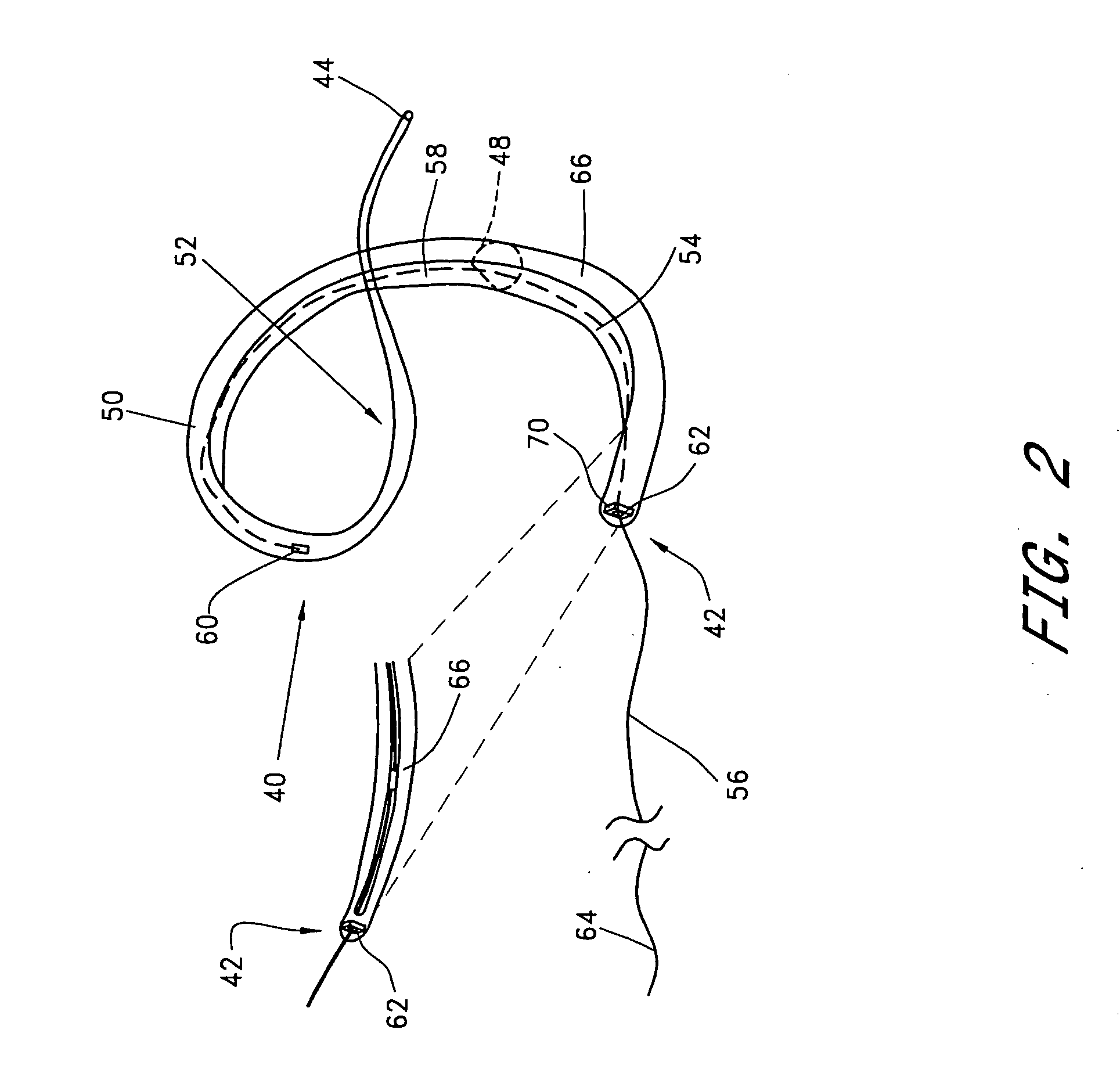 Transluminal mitral annuloplasty