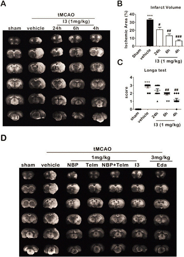 Butylphthalide-telmisartan heterocomplex and preparation method and application thereof