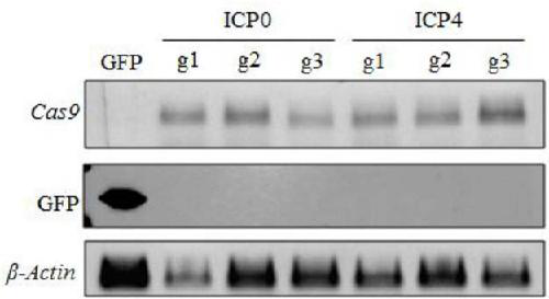 CRISPR/Cas9 system, method and kit for inhibiting HSV-1 copying and/or target sequence expressing and application thereof