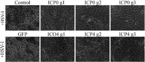 CRISPR/Cas9 system, method and kit for inhibiting HSV-1 copying and/or target sequence expressing and application thereof