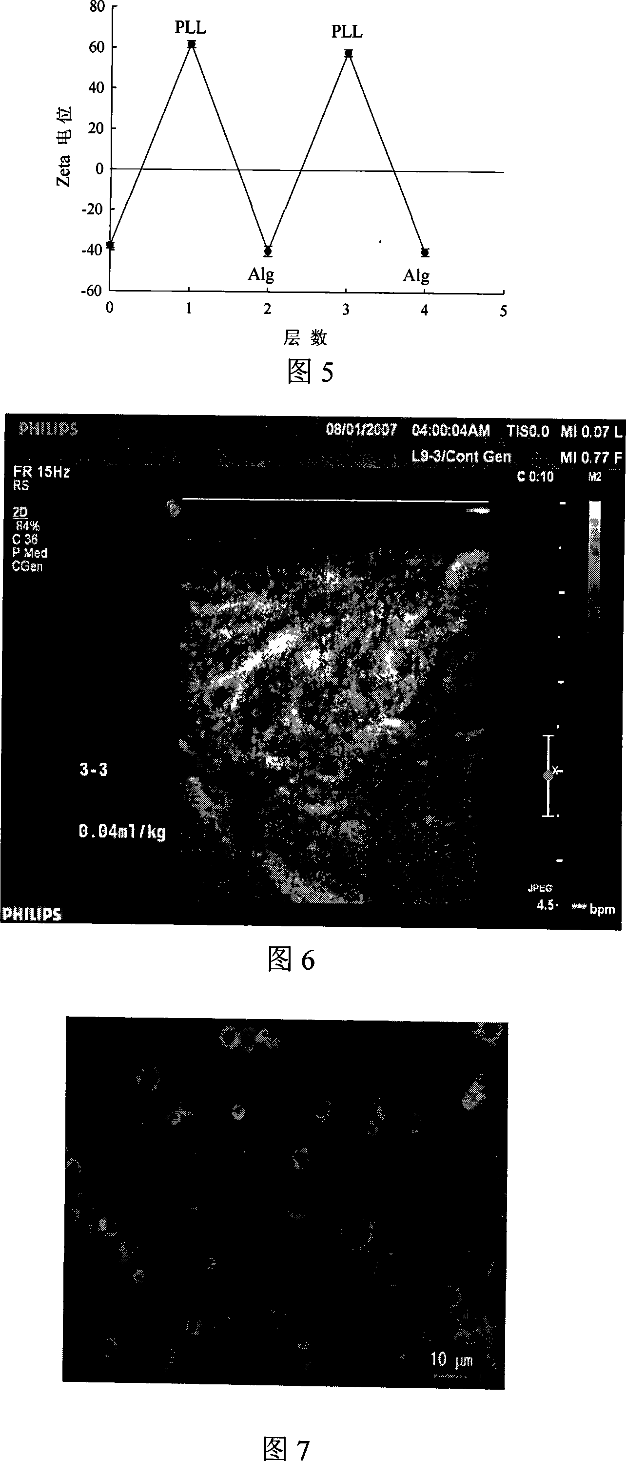 Method for preparing microcapsule coated microvesicle ultrasonic contrast medium