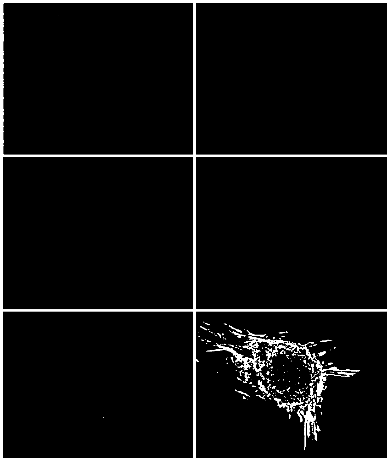 Culture and three-line differentiation induction methods of adipose tissue-derived mesenchymal stem cells