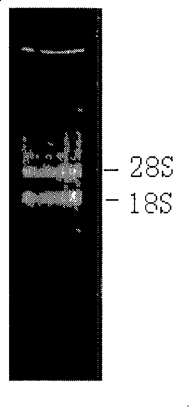 Amphioxus dimethyl arginine hydrolase AmphiDDAH gene and its application