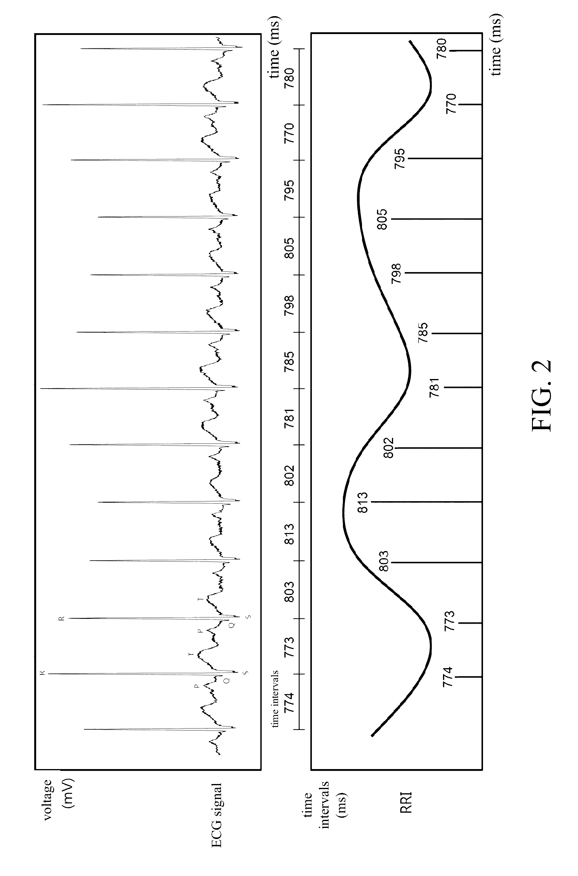 Method and apparatus for estimating depth of anethesia by using ECG signal