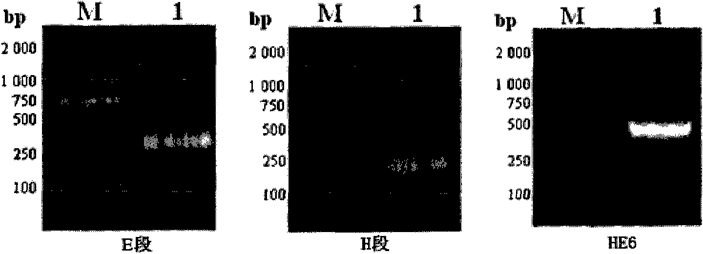 Recombinant fusion proteins of hepatitis B core proteins and tuberculosis antigen or antigen fragments and application thereof