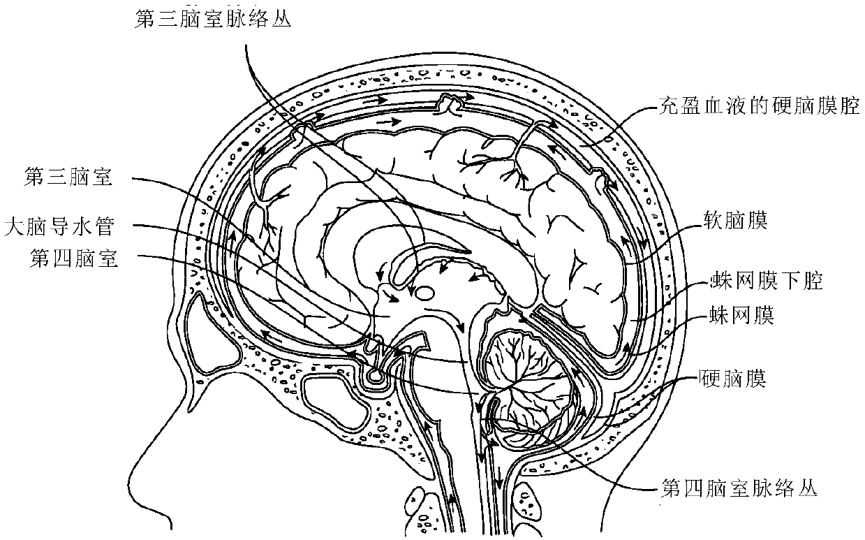 Compound dura mater (spinal dura mater) implant as well as preparation method and application thereof