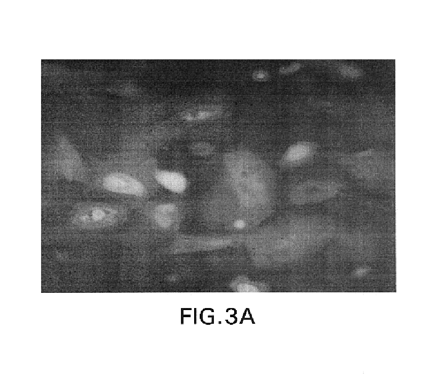 Lentiviral vector-mediated gene transfer and uses thereof