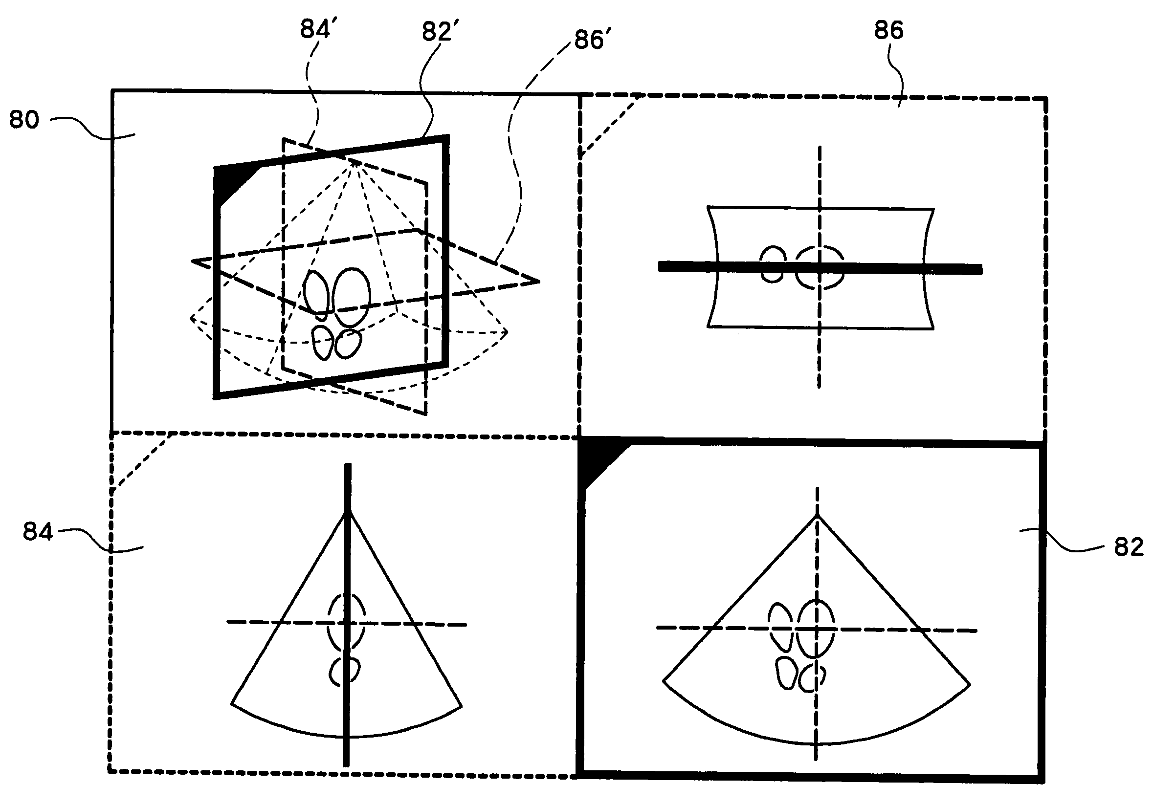 Ultrasonic diagnostic apparatus