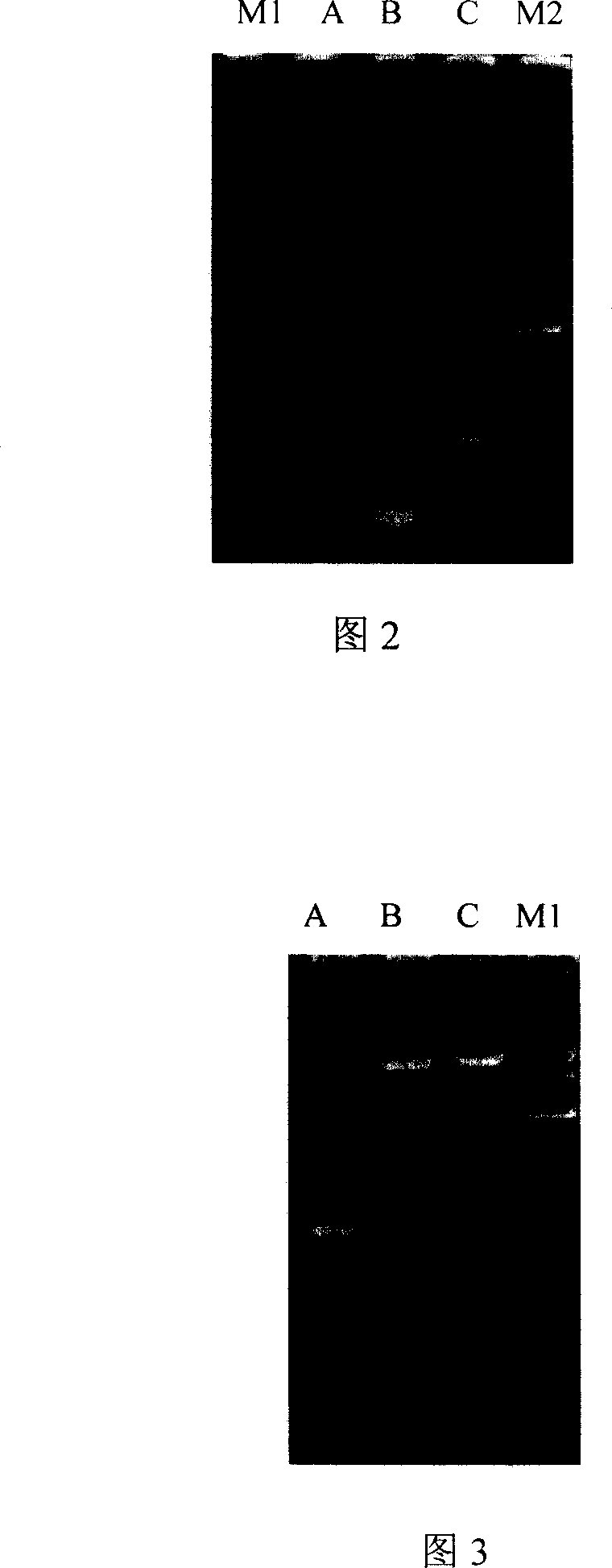 Antineoplastic biological medicament PTD4-GFP-Apoptin fusion protein and preparation method thereof