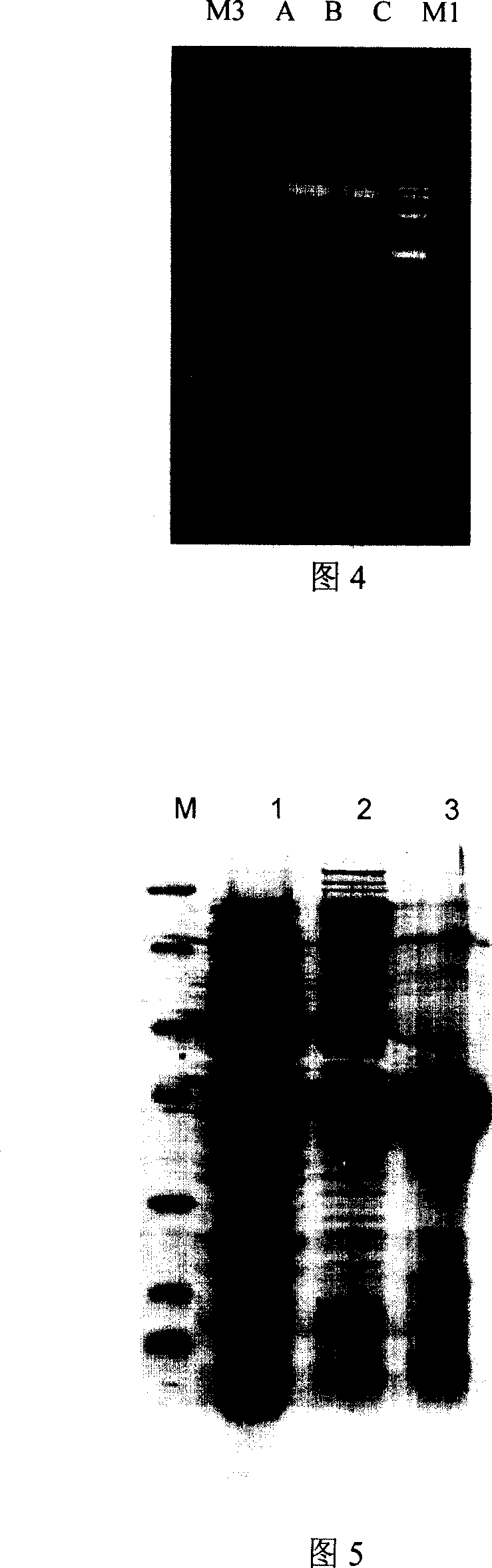 Antineoplastic biological medicament PTD4-GFP-Apoptin fusion protein and preparation method thereof