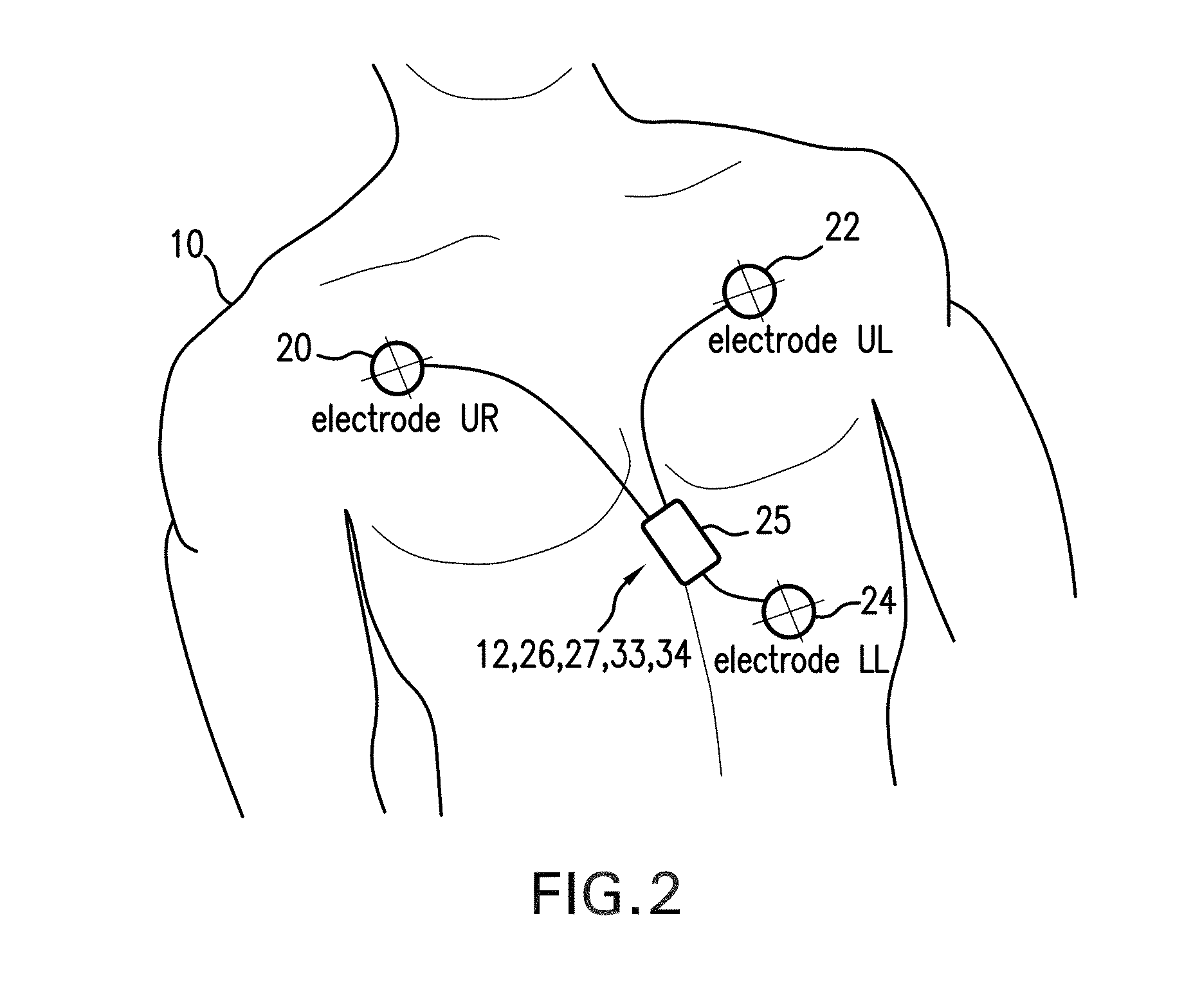 Body-worn monitor for measuring respiratory rate