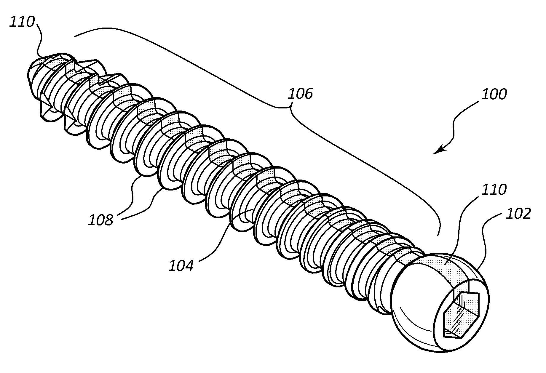 Pedicle screw with electro-conductive coating or portion