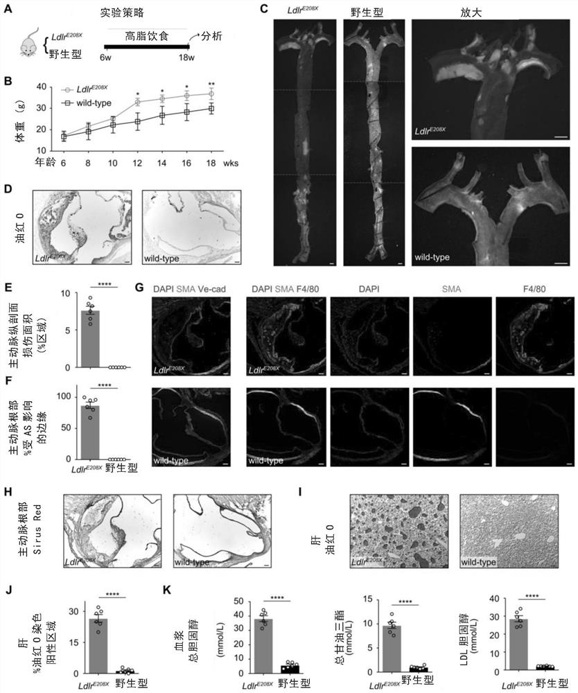 Construction of lipid metabolism disorder animal model and repair using AAV-CRISPR/CAS9