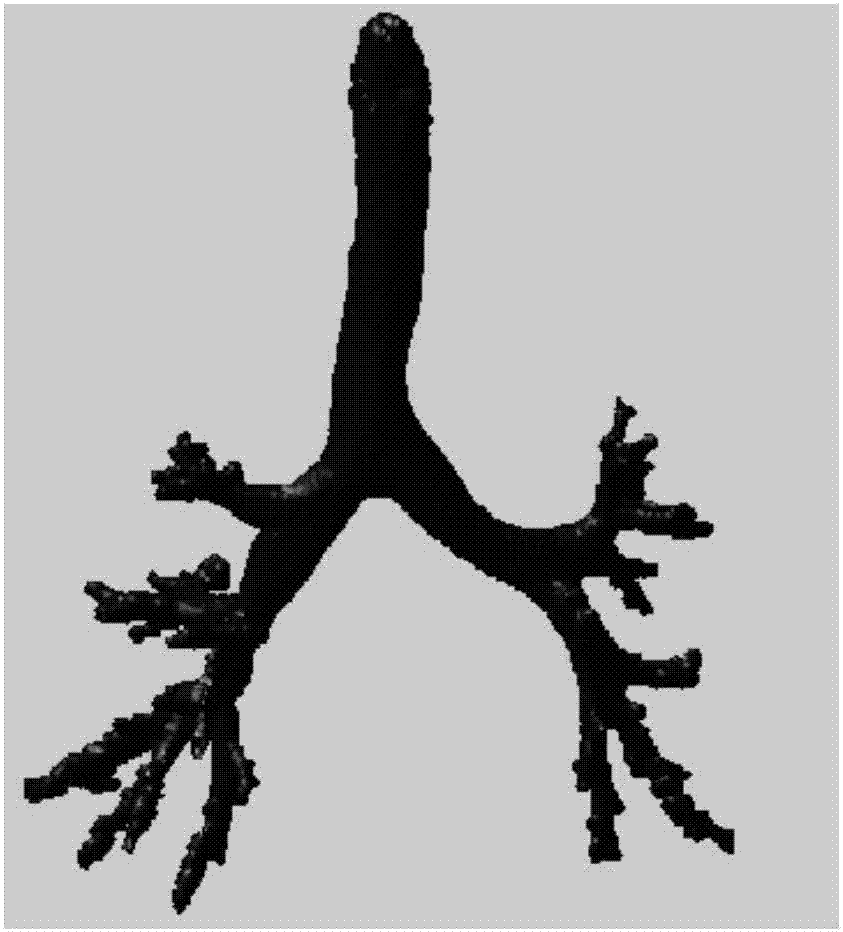 Pulmonary CT image airway three-dimensional skeleton dendritical structure extracting and marking method