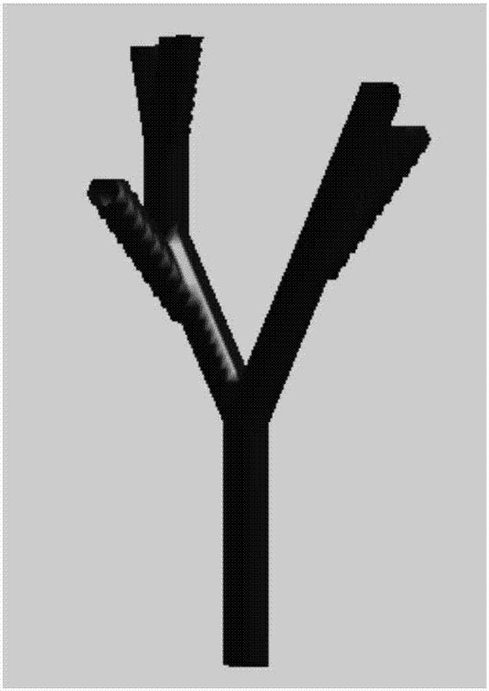 Pulmonary CT image airway three-dimensional skeleton dendritical structure extracting and marking method