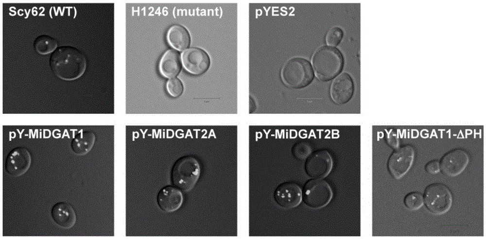 Polypeptide for improving triacylglycerol synthesizing capability of MiDGAT1 in beer yeast and application of polypeptide