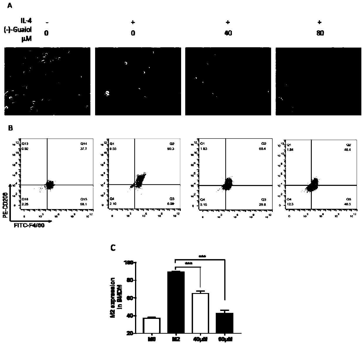 Application of guaiol in preparing drug for inhibiting tumor related M2 macrophage