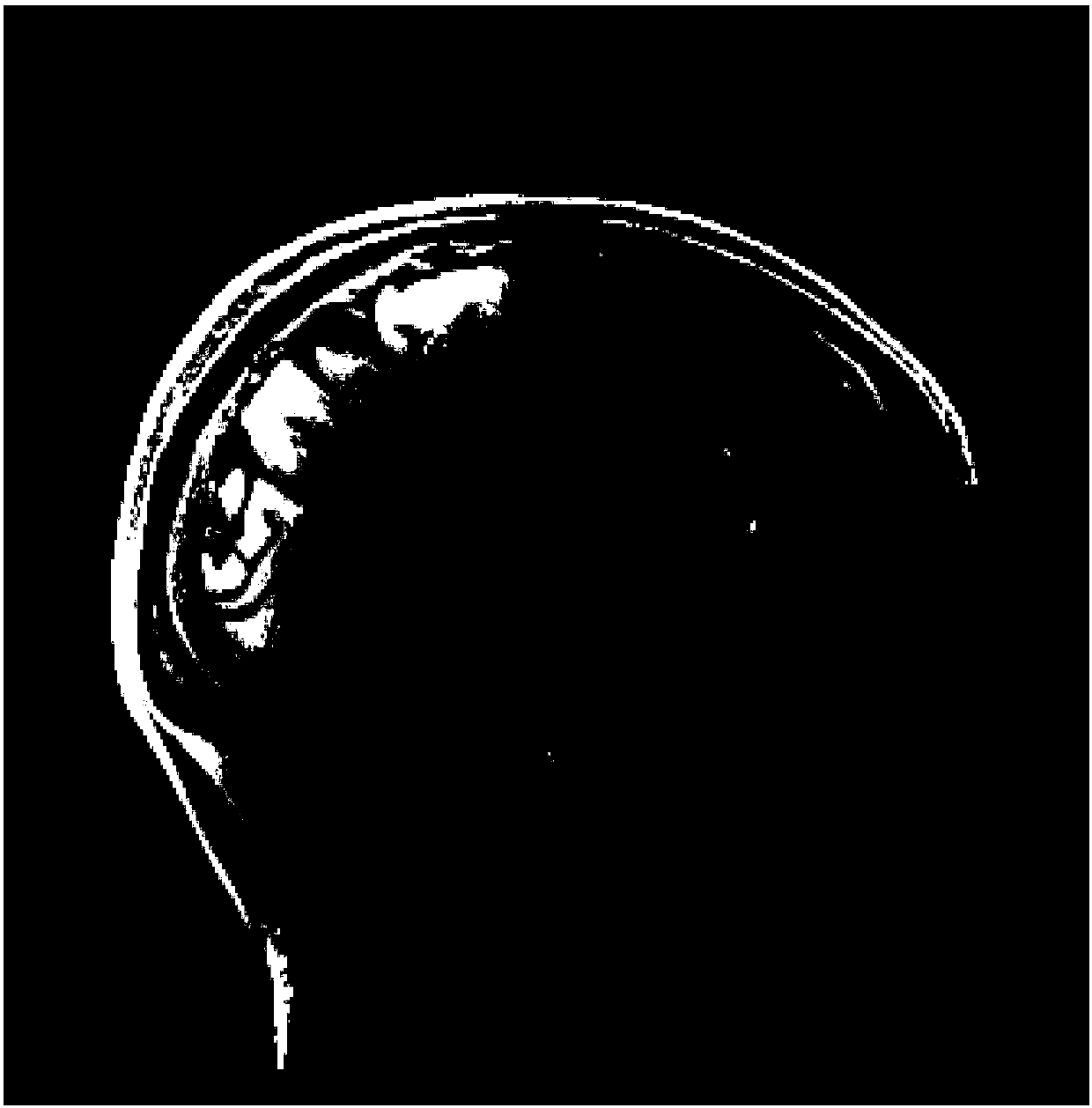 A Method for Describing Local Morphological Features of the Brain Based on Cortical Vertex Clouds