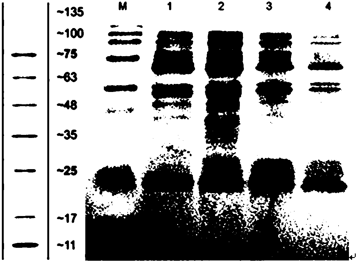 Bacillus megaterium, polypeptide agricultural microbial agent thereof as well as preparation method and application of polypeptide agricultural microbial agent