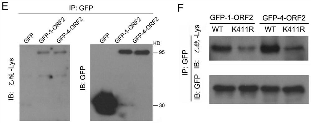 Acetylated hepatitis E virus capsid protein orf2 and use thereof